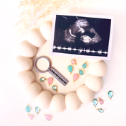 A black engraving heartbeat keychain sits in a dish with a photo of an ultrasound and sonogram and scattered with pink and blue gems. Each keychain is carefully engraved with your actual image of your babys sonogram. Sentimental baby keepsake, stillborn baby keepsake, personalized postpartum gift, loss of baby gift