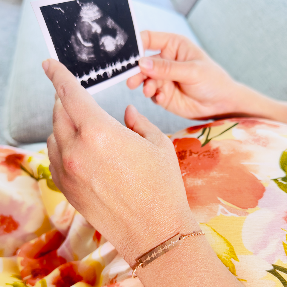 A person in a floral dress is wearing a personalized engraved heartbeat bracelet and looking at an ultrasound image with a sonogram. Each bracelet is crafted by hand and engraved with your actual image of your babys sonogram or ekg image. 